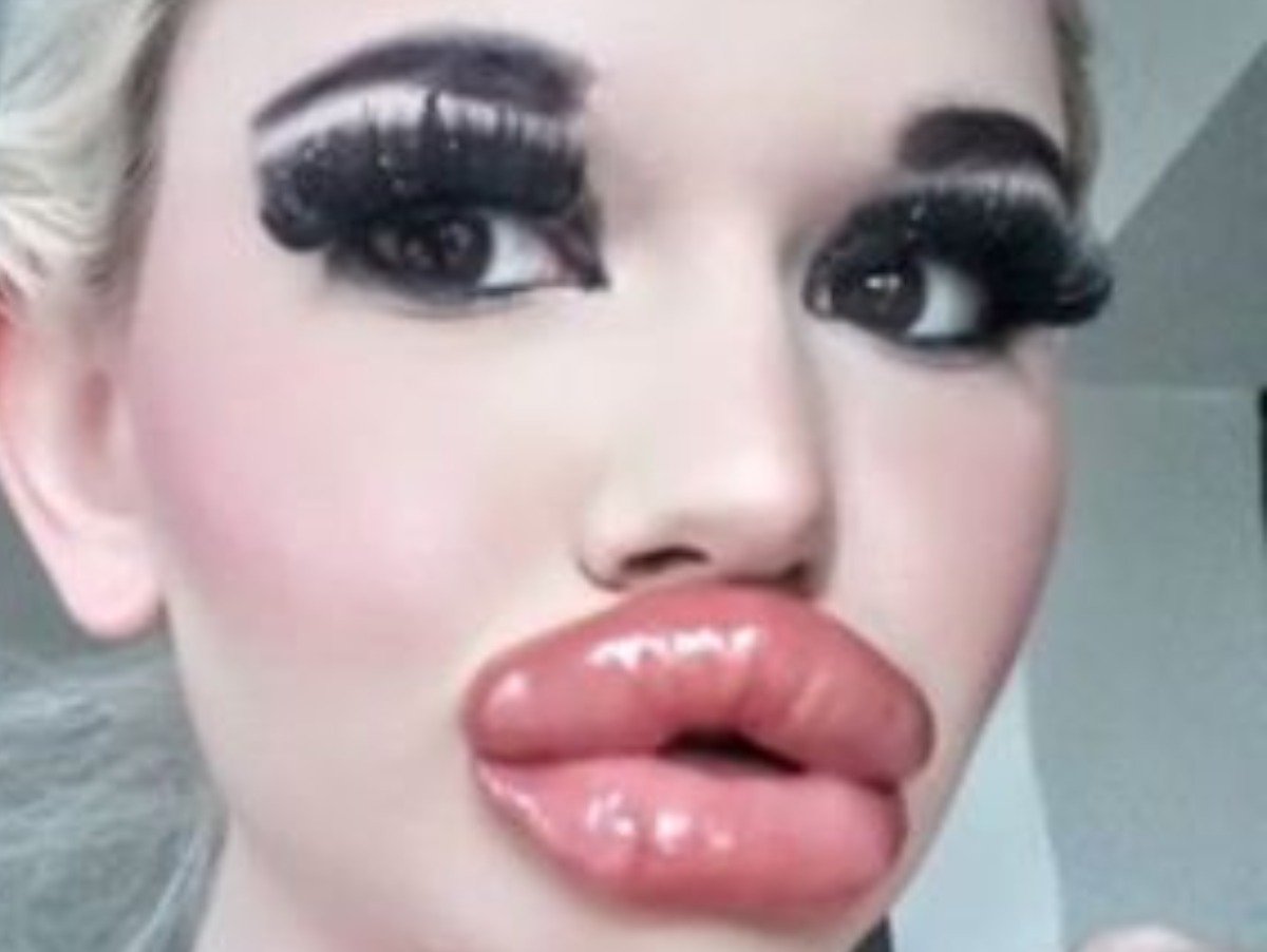 World S Biggest Lips Andrea Ivanova Goes Viral After Getting Lip