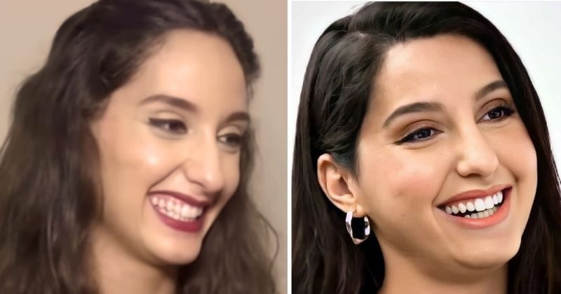 Nora Fatehi Before Surgery Old Video Has People Debating If She Has