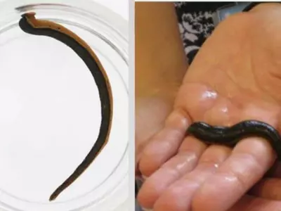 Bizarre new species of leech with 3 jaws and 59 teeth discovered