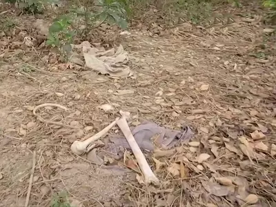 human skeleton found dumped near hospital