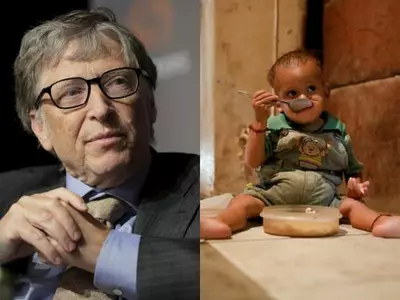 Bill Gates malnutrition