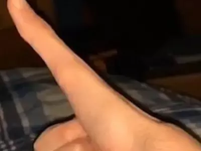 long thumb