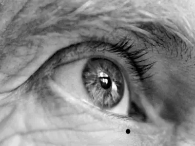 Eye Health: Dispelling the Myths of Eye Donation