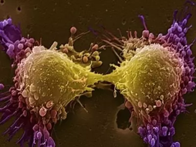 New Tech may Help Diagnose Cancer Early