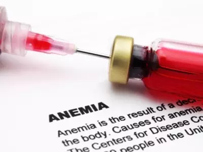 Anaemia test