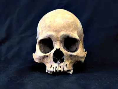 Dogs Offer Clues to Human Skull Development