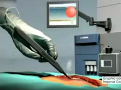Smart Knife Detects Cancer in 3 Seconds