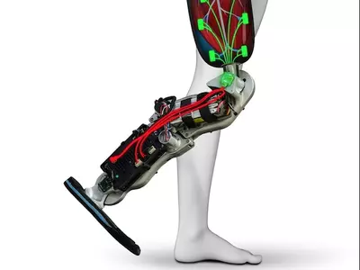 computer-controlled bionic leg