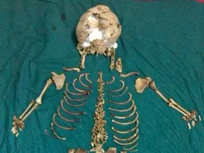 the skeleton of a foetus