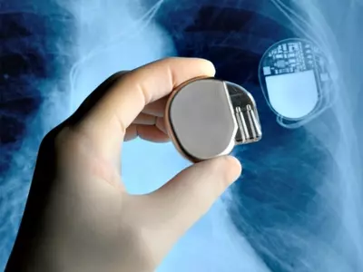 Pacemakers That Could be Wirelessly Charged