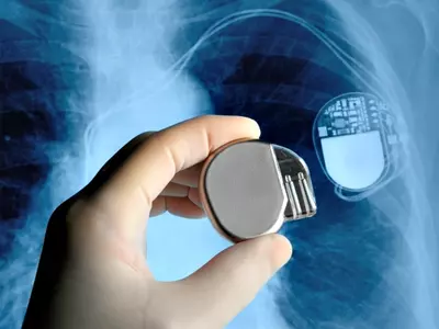 Tiny Wireless Pacemaker A Game Changer