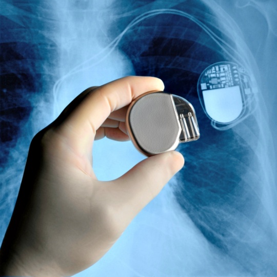 Tiny Wireless Pacemaker A Game Changer