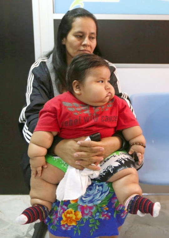 8-Month-Old Chubby Colombian Baby Weighing 20 Kgs Rescued by Charity ...