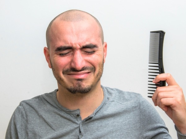 Home Remedies For Alopecia Hair Loss Prevention Healthy Living