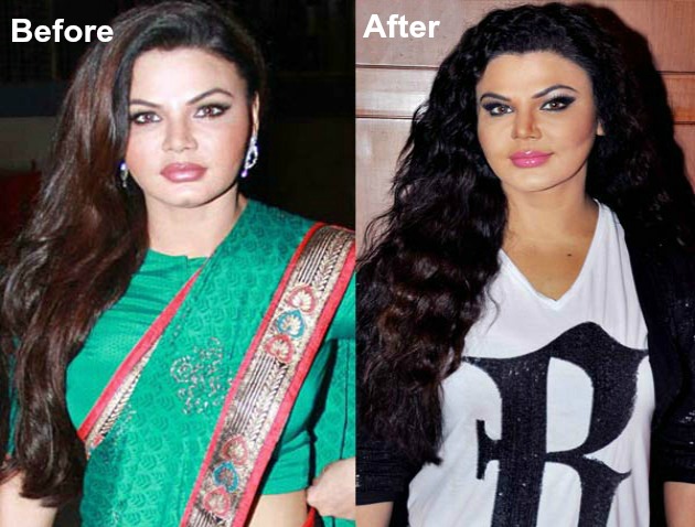 16 Famous Celebs Who Opted For Plastic Surgery And Regretted It Instantly