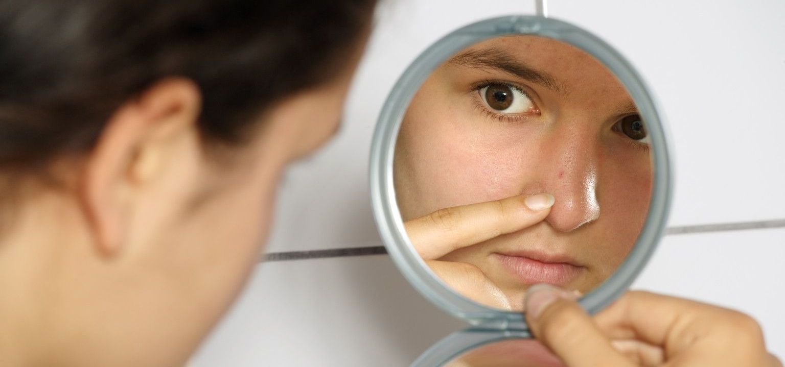 Tired Of Recurring Pimples Here Are Simple Home Remedies Thatll Help 