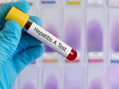 hepatitis c test