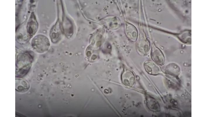 Scientists Find Mysterious Lifeform That Lives Without Oxygen Right