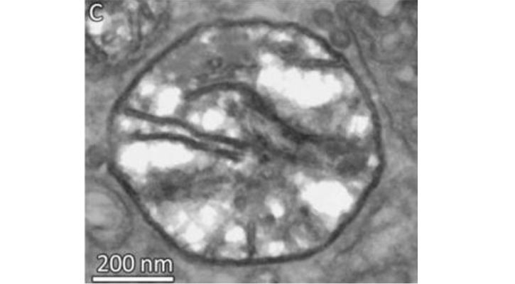 Scientists Find Mysterious Lifeform That Lives Without Oxygen Right
