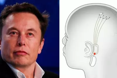 Elon Musk's Neuralink Brain Implant Will Be Ready By December 2020, And Give You Superpowers