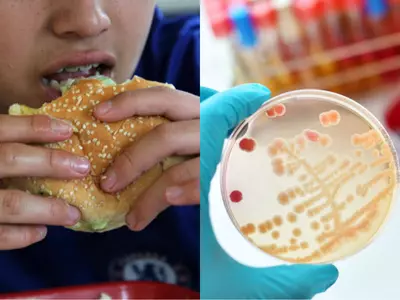 food bacteria