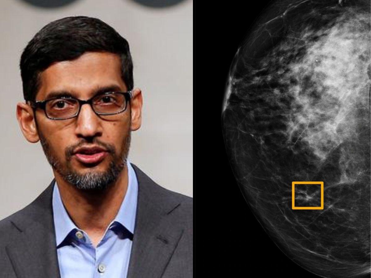 Google Uses Artificial Intelligence to Detect Breast Cancer