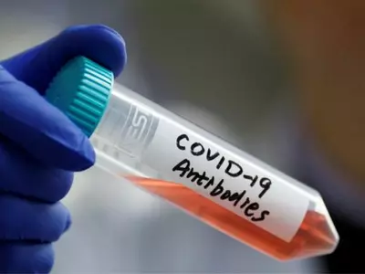 covid-19 antibodies