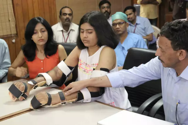 Pune Woman Undergoes Rare Hand-Transplant, Donor Hand Colour Soon Changes To Match Hers