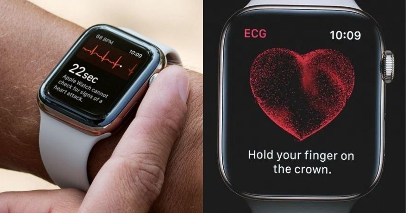 Apple Watch Saved 80 Year Olds Life Detects Heart Condition That Hospital Machine Missed 4607