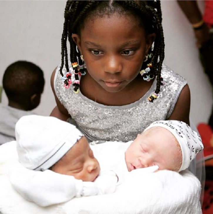 Rare Nigerian Twins Look Nothing Like Each Other As Both Are Born With.