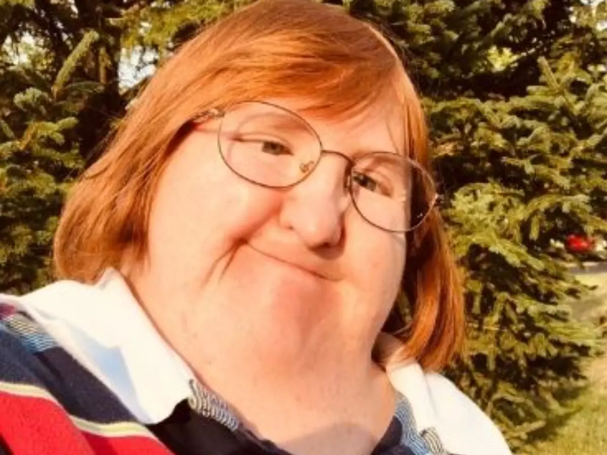Woman Called 'Too Ugly' By Trolls Posts One Selfie Everyday