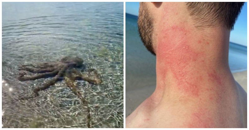 Australian man faces rare attack by an angry octopus 