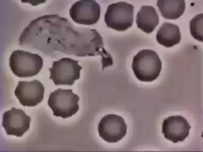 white blood cells killing bacteria
