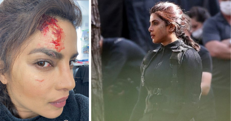 Citadel' Star Priyanka Chopra Jonas Reveals On-Set Injury