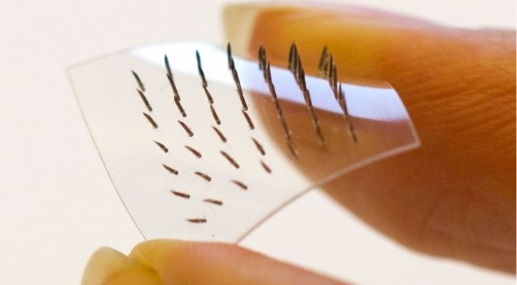 microneedle patch