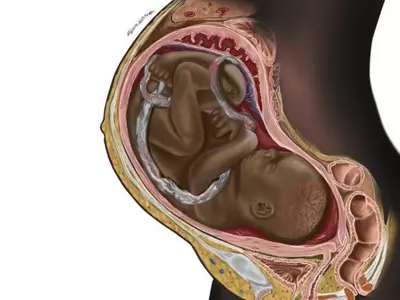 black fetus illustration