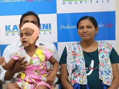 hyderabad doctors perform rare surgery on 3 year kid suffering from laughter seizures