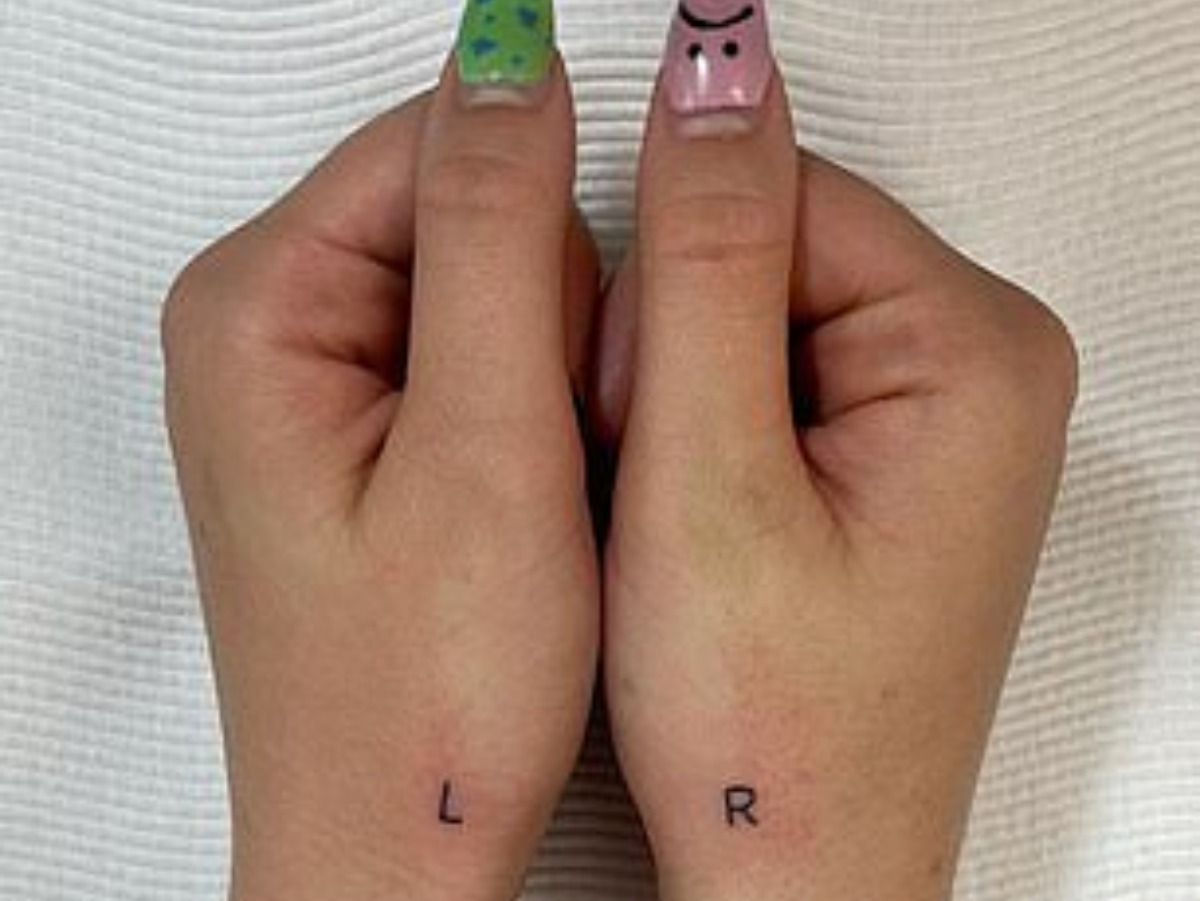 Woman Gets Letters L  R Tattooed On Her Hands After Getting Confused  Between Left and Right Hand