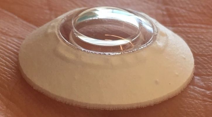 artificial corneal implant
