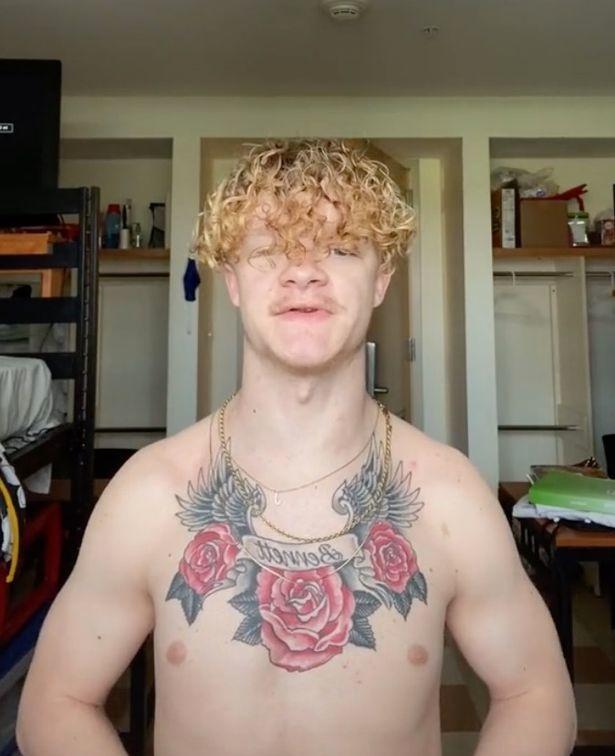Watch Man Born With No Collarbones Claps With His Shoulders
