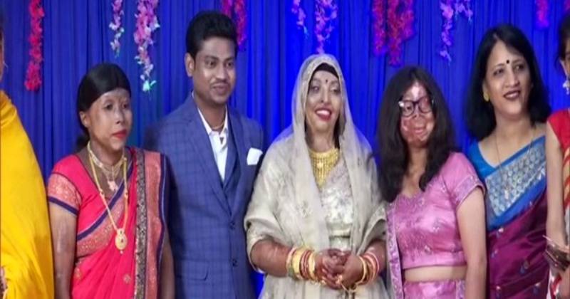 12 Years After Brutal Acid Attack, Survivor Marries Long-Time Friend ...