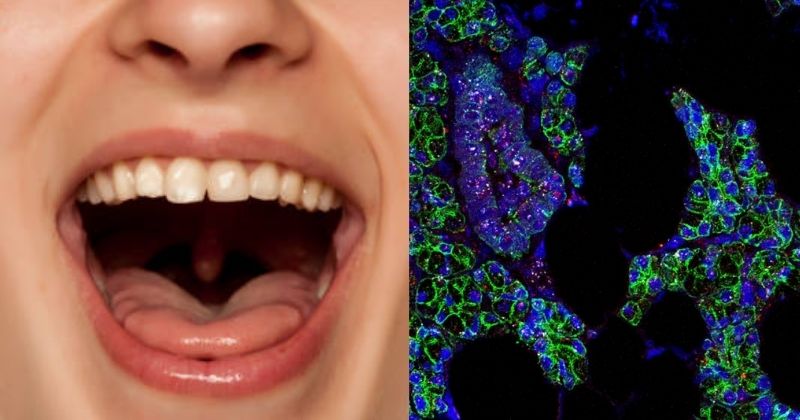 COVID-19 causes loss of taste because the infection targets cells in the mouth: Study