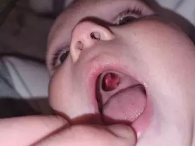 She called her husband to come and check the hole in the mouth of the baby. The toddler wasn't letting the mother come closer and inspect,  LADbible reported. 