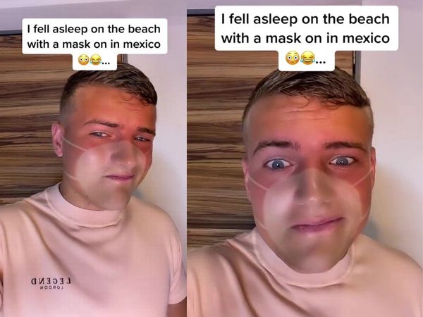 Man Tries To Fool People Into Thinking He Has Tan Lines