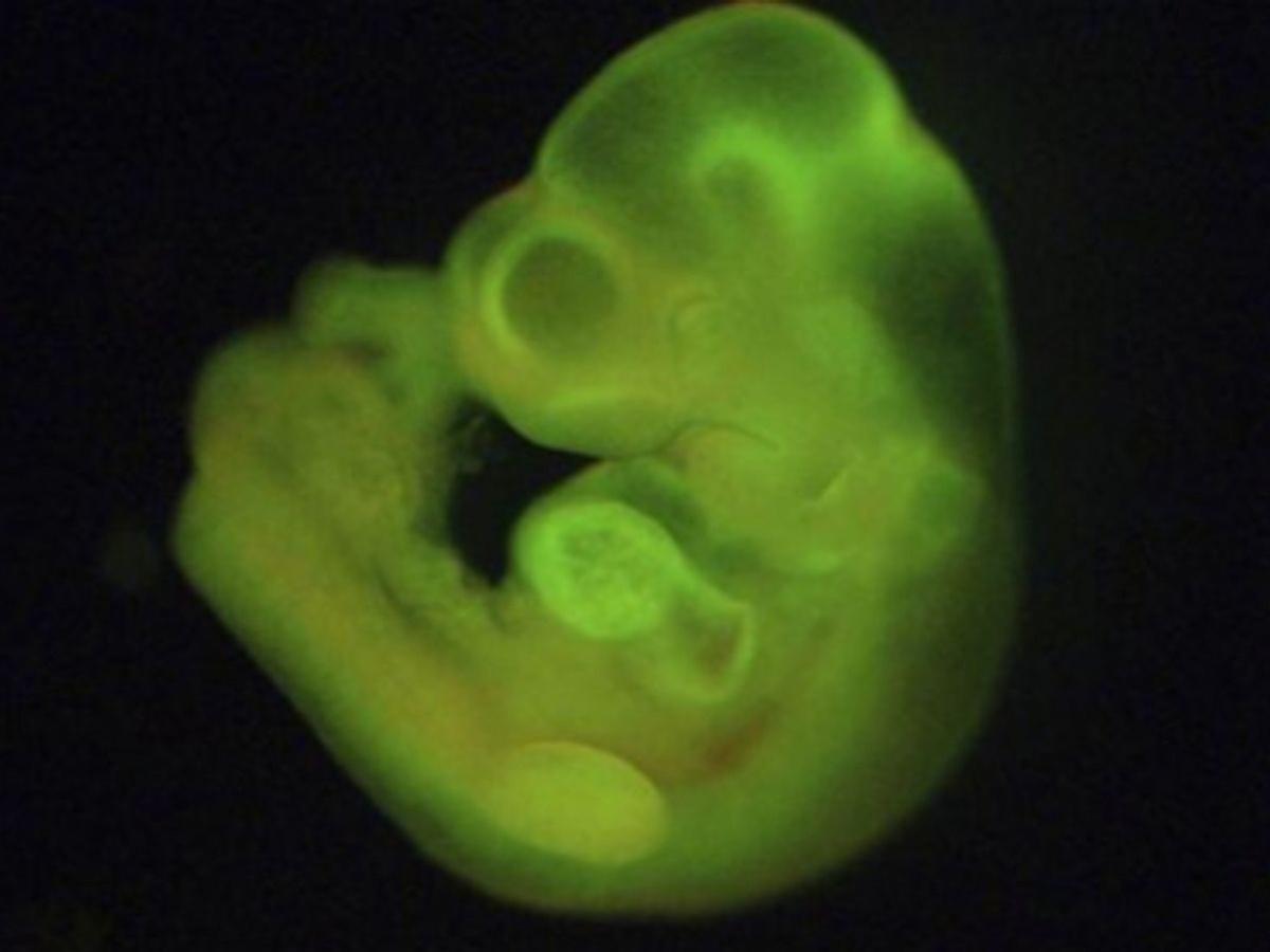 Scientists Can Now Grow Bigger Human Embryos In Labs To Unlock Health  Secrets