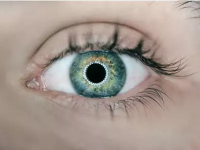 An eye is pictured in this image