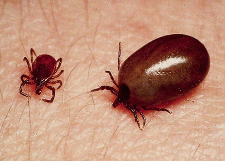 Explained: What Is Scrub Typhus, A 'Mysterious' Infection That's Affecting Children In UP