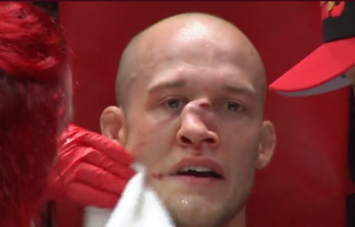 MMA Fighter Blake Perry Suffers Horrific Broken Nose