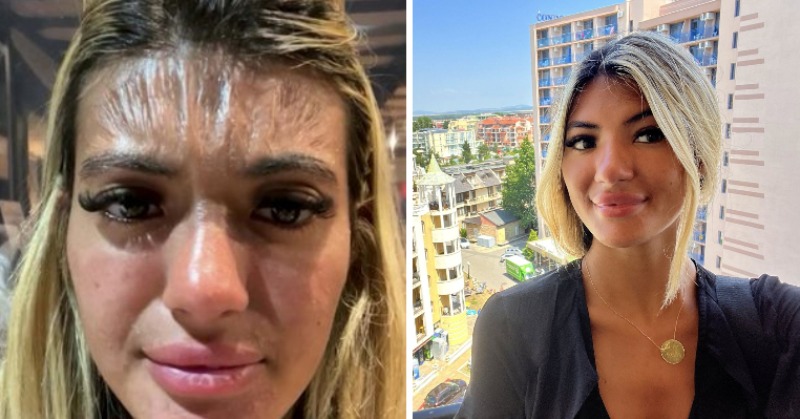 Fake tan turns woman green leaving her 'looking like Fiona from