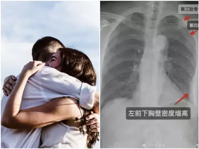 woman sues co worker for hugging hard and breaking three ribs 